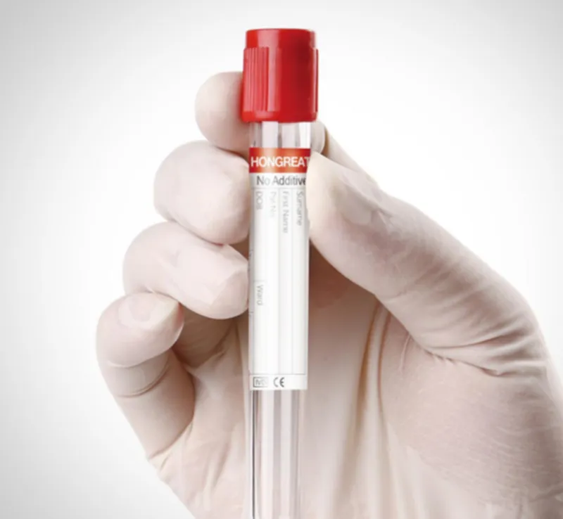 Blood Collection Tube Production Turnkey Solution